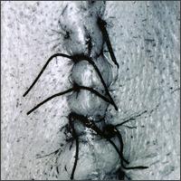 Infliction von Scheer