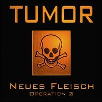 Neus Fleisch Operation von Tumor