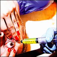 Acid or Blood von Racebannon